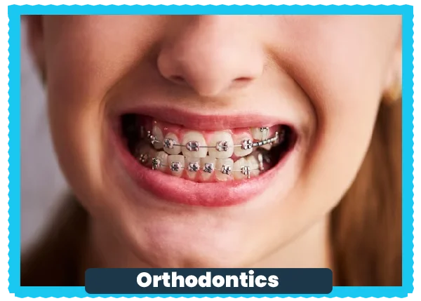 Braces
