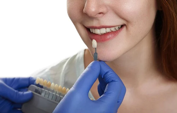 Veneers